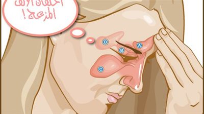 ١٠ علاجات طبيعيه لاحتقان الانف في المنزل
